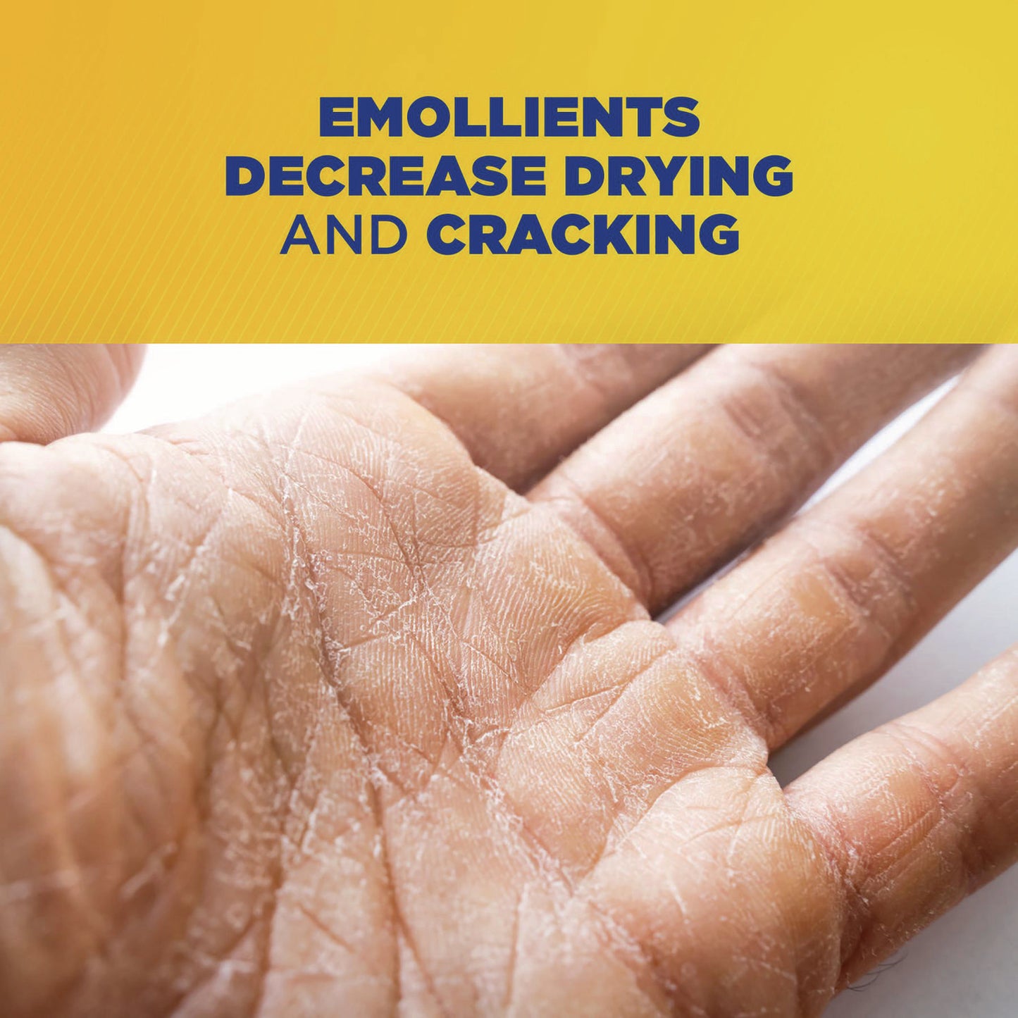 Zep Commercial Cherry Bomb Gel Hand Cleaner, Cherry Scent, 48 oz (ZUCBHC484EA)