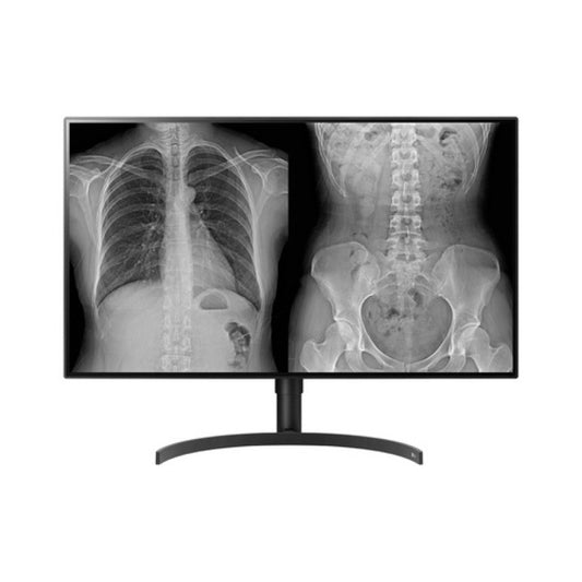 LG 32in Medical Ips 8mp Diagnostic Monitor 3840 X 2160 Dp Fda 510k Class Ii Taa (32HL512DB)